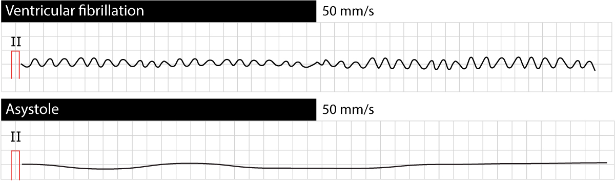 The Physiology of Cardiac Arrest and Arterial Bleeds: Why Every Second Counts